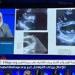 مصر تلمع في سماء الطب العالمي.. «شيرين عبد السلام» تمثل مستشفى الناس في أكبر مؤتمر دولي لعيوب القلب الهيكلية - الهلال الإخباري